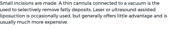 Small incisions are made. A thin cannula connected to a vacuum is the used to selectively remove fatty deposits. Laser or ultrasound-assisted liposuction is occasionally used, but generally offers little advantage and is usually much more expensive.